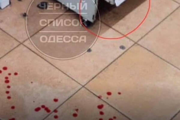  Одесситка подскользнулась и разбила лицо в "Обжоре": как отреагировали в магазине