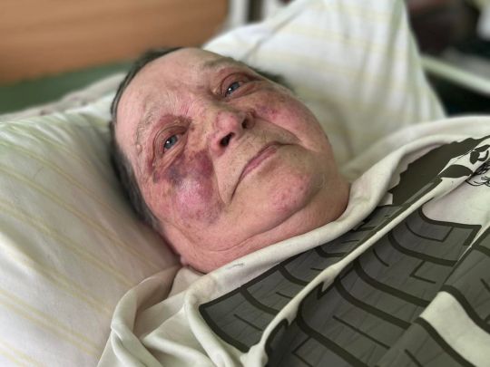 «Втекла дивом»: рашисти ледь не до смерті побили пенсіонерку через український паспорт